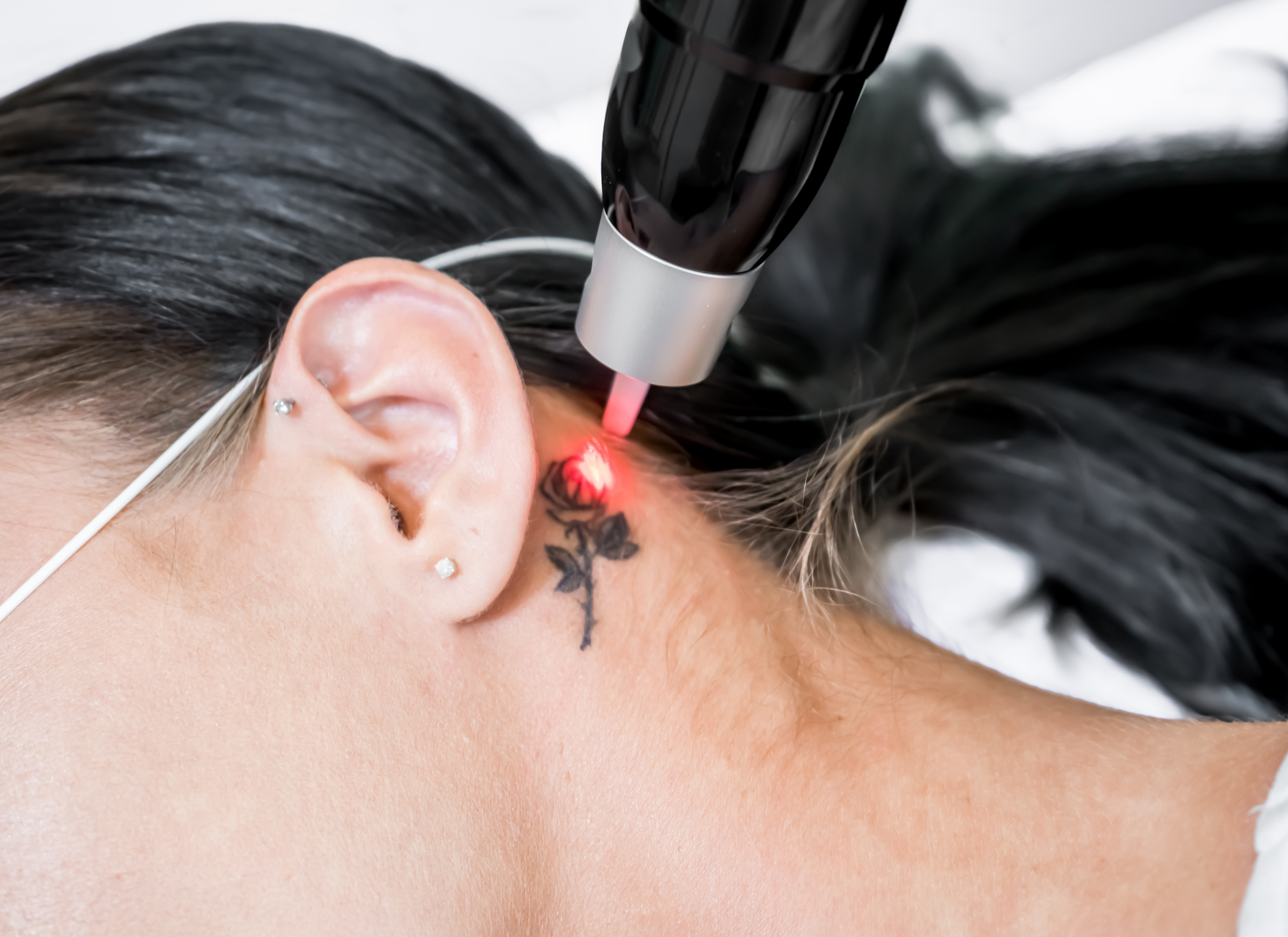 kleine tattoo verwijderen maarssen